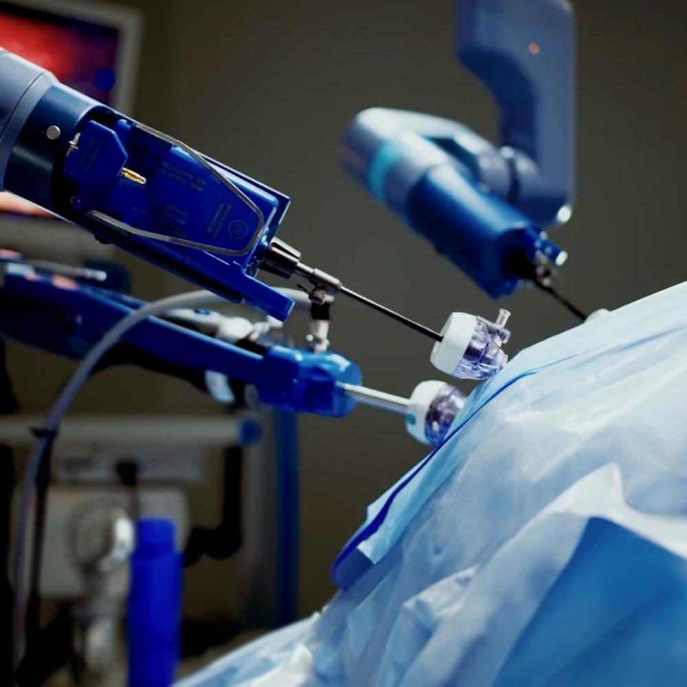 close up of minimally invasive robotic tools 